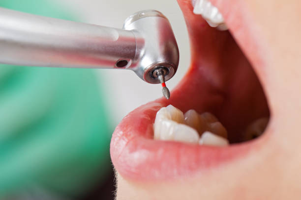 Best Emergency Treatment for Jaw Pain or Injury in Osprey, FL